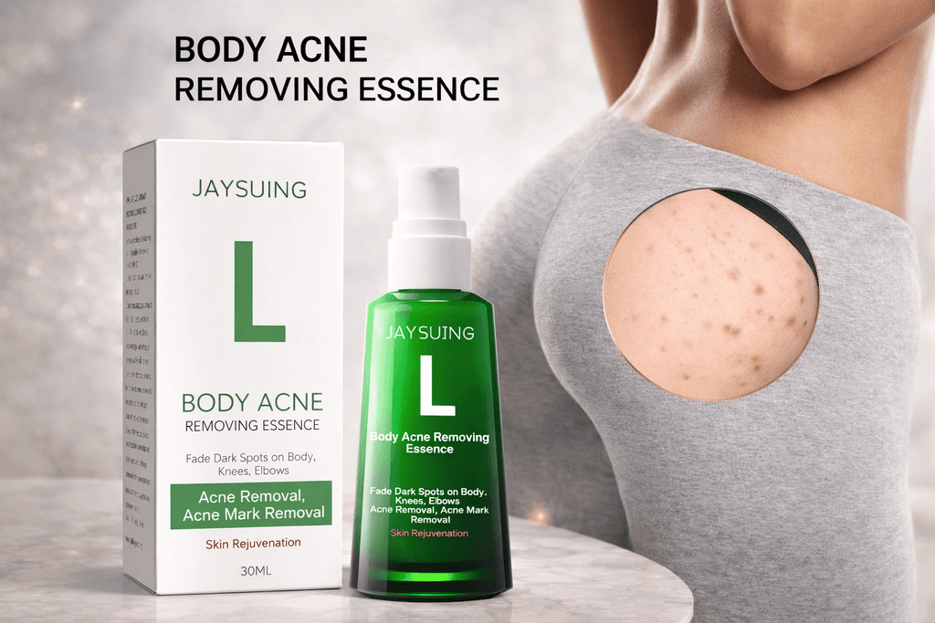 Esencia blanqueadora Jaysuing, antiacné, aclara las imperfecciones y marcas del acné, hidratante, blanqueadora y cuidado de la piel.